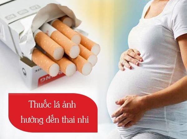 Khi mang thai cần tránh những gì?